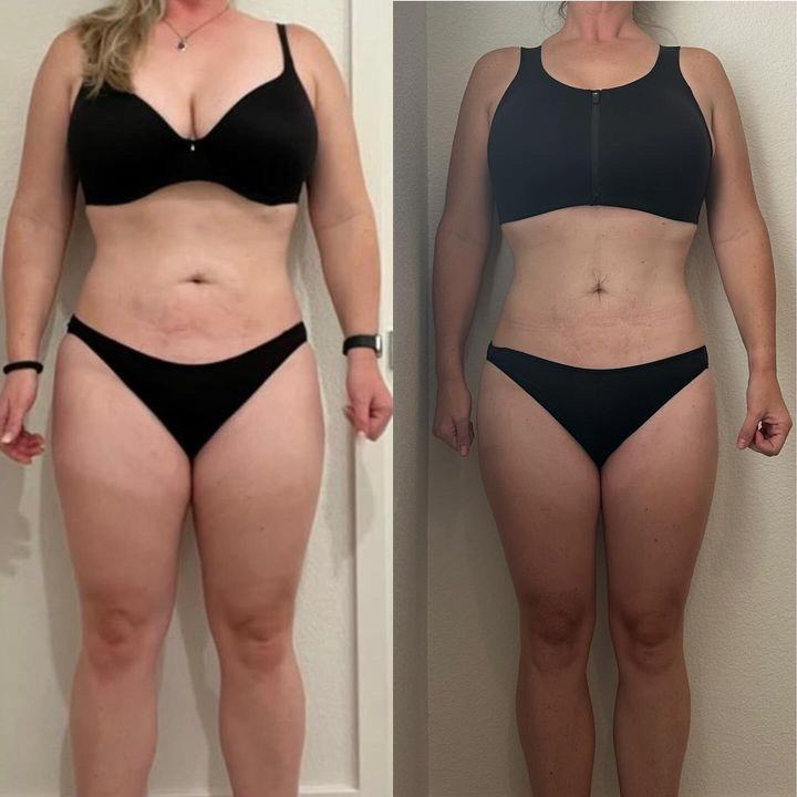 Before and After Image: Weight Loss - front