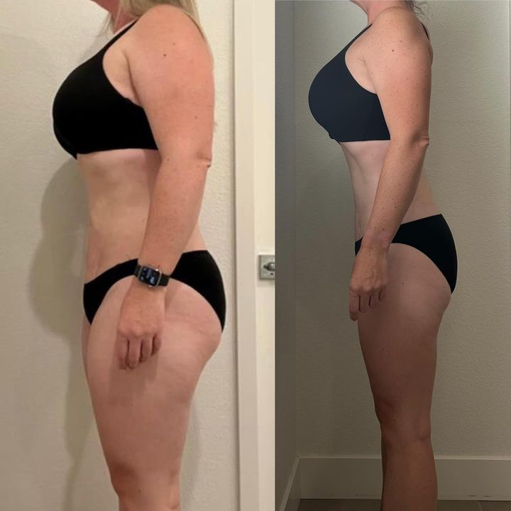 Before and After Image: Weight Loss - left-side