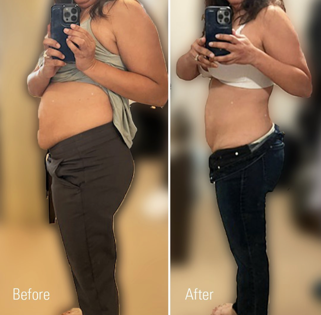 Before and After Image: Weight Loss - left-side
