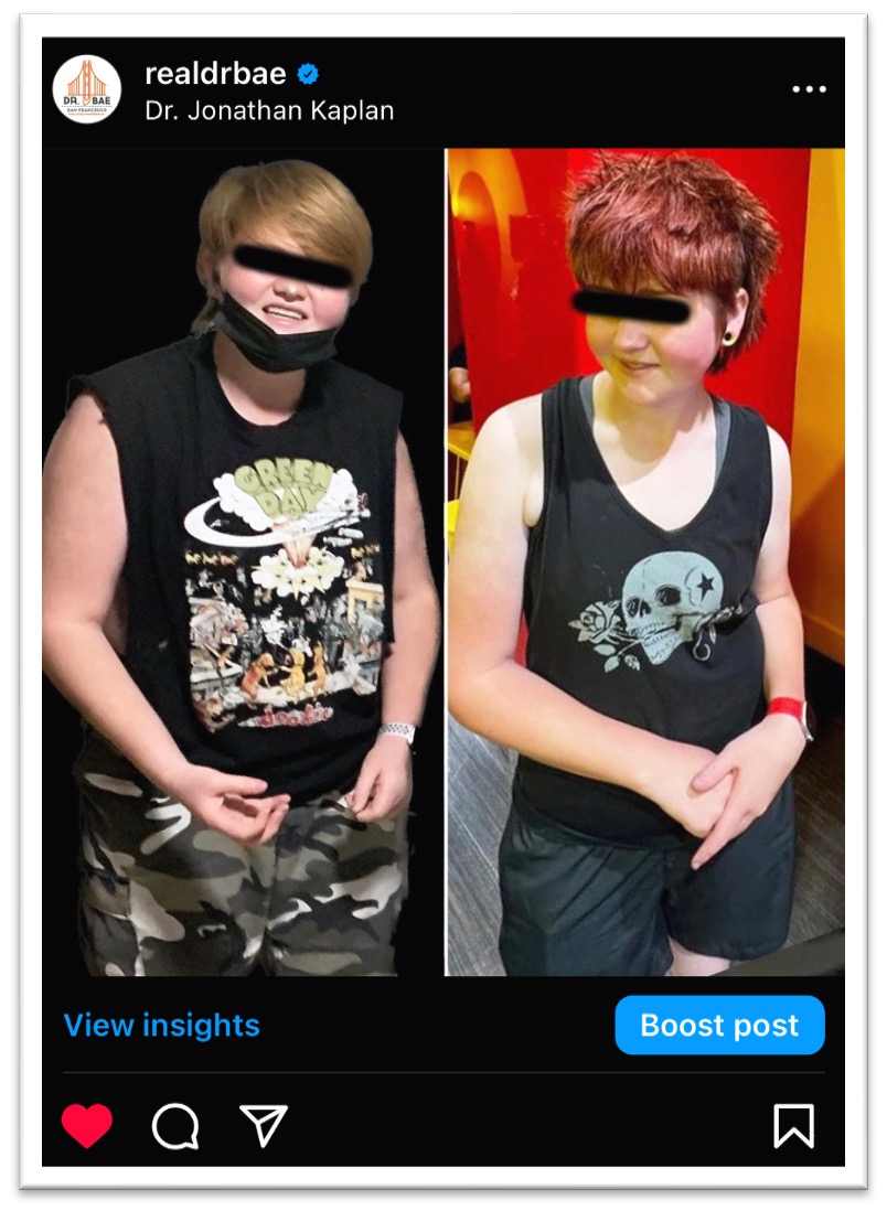 Before and After Image: Weight Loss - front