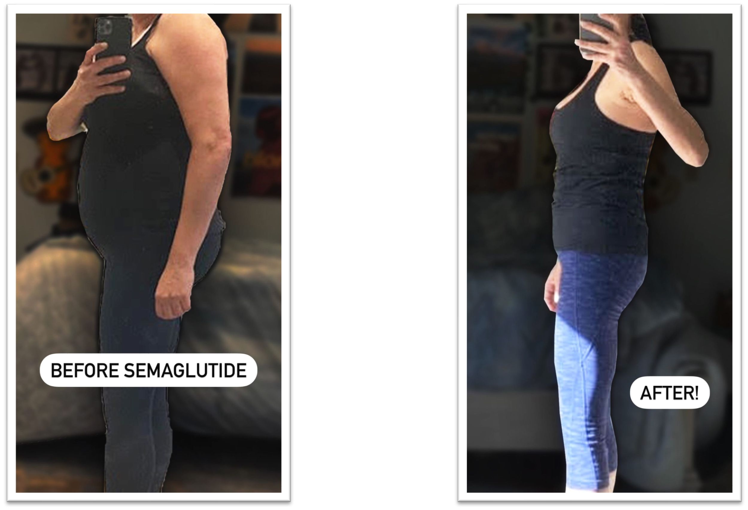 Before and After Image: Weight Loss - left-side