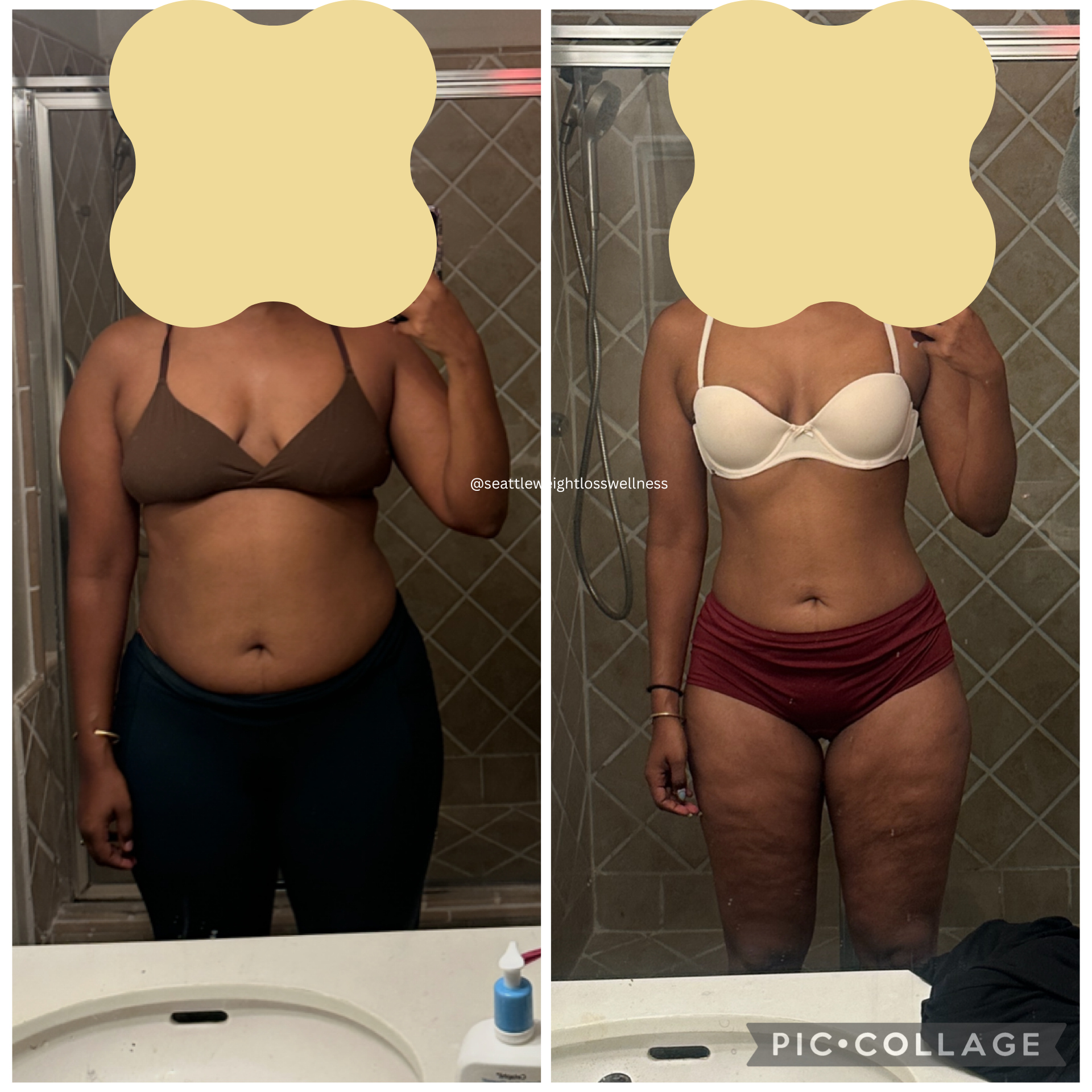 Before and After Image: Weight Loss - front